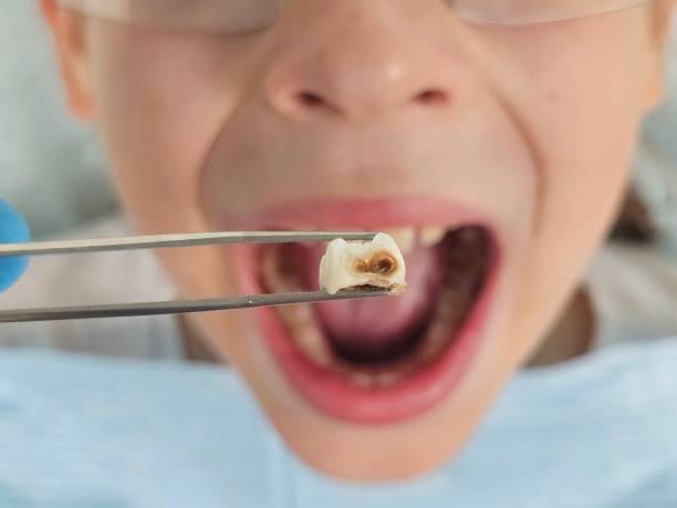 Best 24-Hour Emergency Dentist in Laymantown, VA